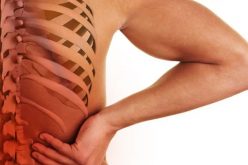 Spinal Stenosis: Understanding the Condition and Its Effects